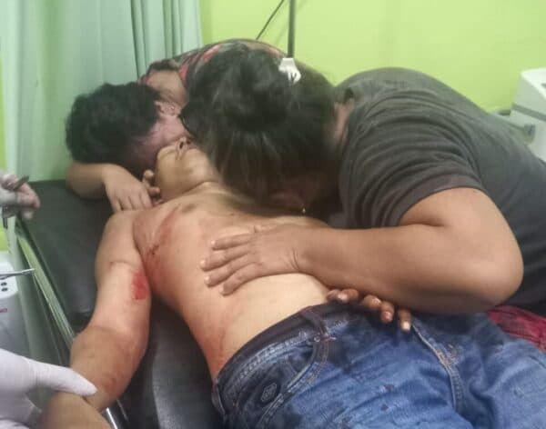 Tidak Terima Adiknya Dilaporkan Polisi, Pelaku Tikam Tetangga Hingga Tewas di Jabung