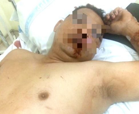Anggota TNI Dikeroyok Sekelompok Orang