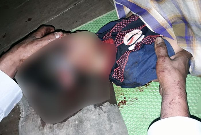 Seorang Bocah Tewas Usai Dibacok Orang Gila